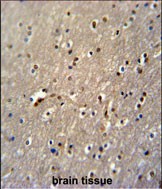 IHC-P - GLD2 Antibody (N-term) AP5092a